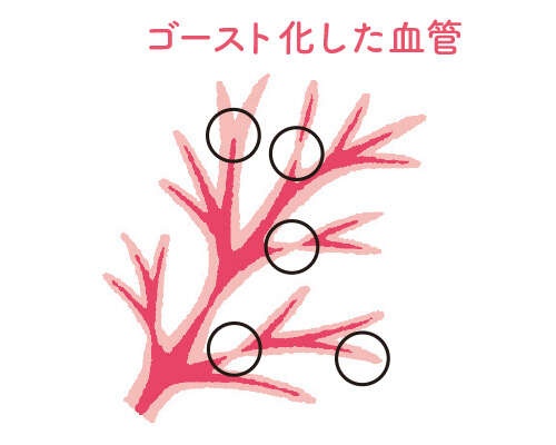 みそ汁は1日2杯！ 温活ドクターも実践する「冷えも乾燥も改善する7つの習慣」（4）