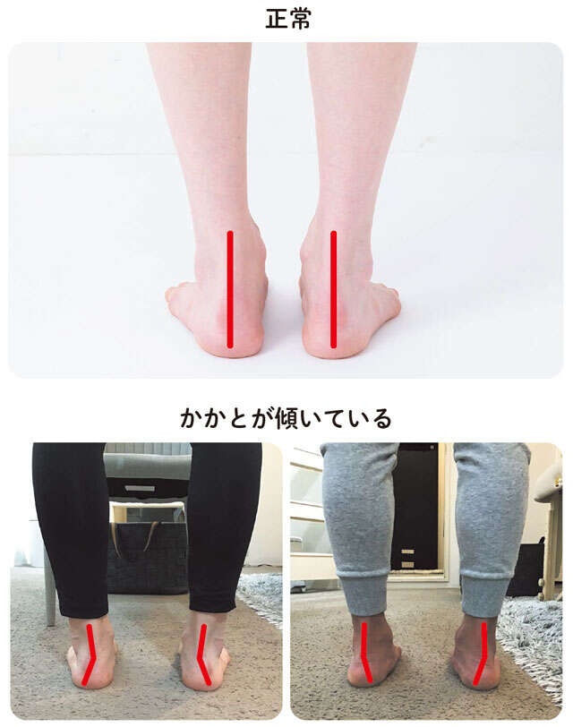 【坐骨神経痛対策】自分の足の状態が分かる4つのポイント。小さな段差につまずく方は要注意！（5）