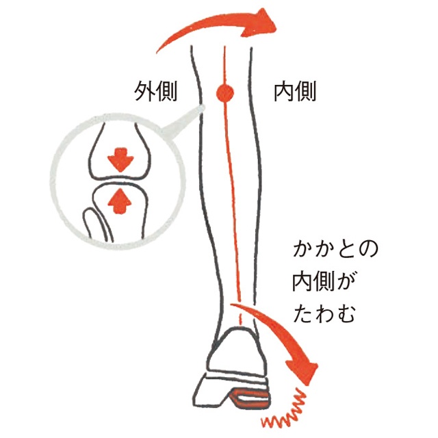 「ひざトラブル」で運動不足...という人に！「ひざにやさしい靴」でのウォーキングのススメ（5）