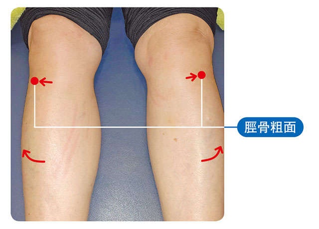 ひざ痛に悩む方は必見！ 「ひざのねじれ」についてセルフチェック／ひざ痛ほぐし1分ストレッチ（4）
