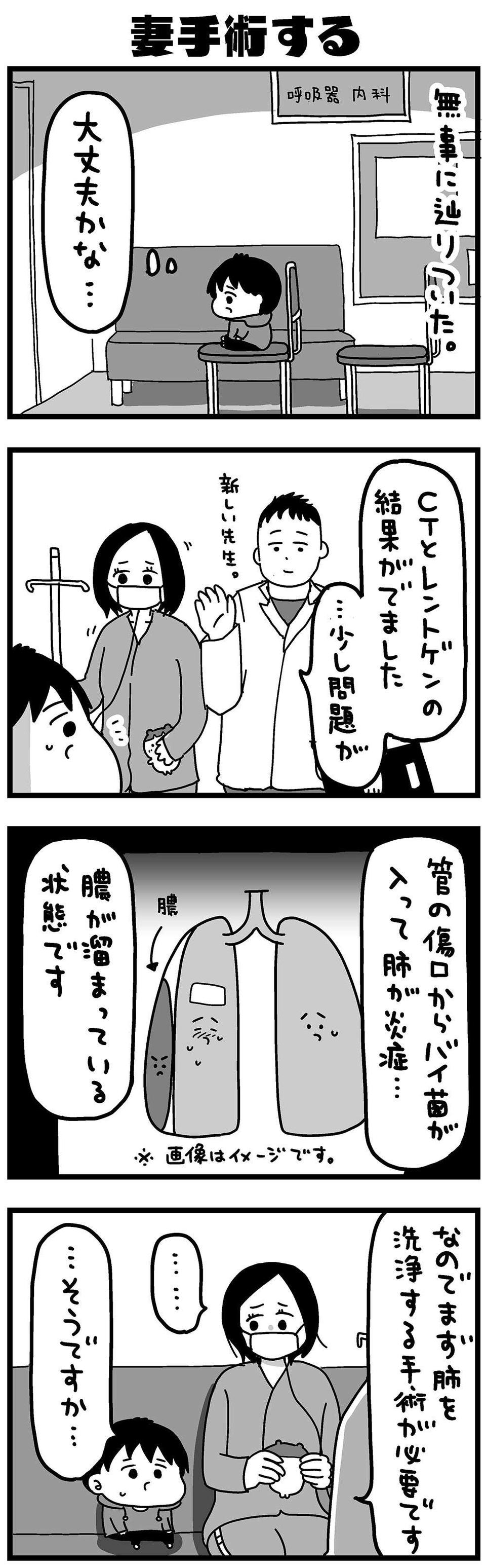 『大好きな妻が難病になった話～ふうふの日記マンガ～』（51）