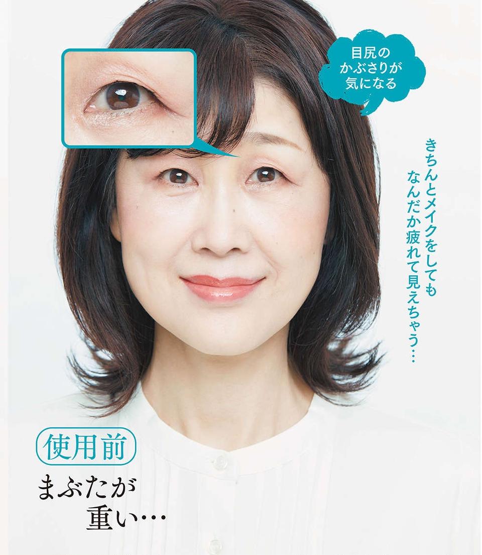 えっ、これだけで？ たるみまぶたに貼るだけで簡単リフトアップ！ 魔法のようなアイテープ登場＜PR＞（2）