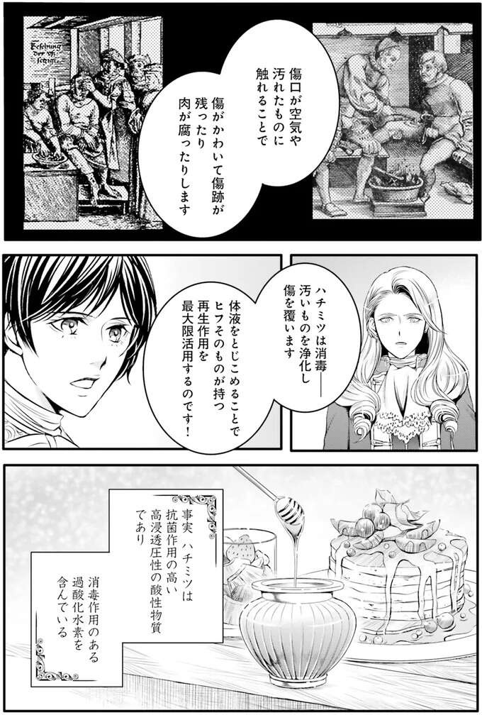 カギとなるのはハチミツ。18世紀に現代治療を実現せよ！／現代OLが18世紀フランスにタイムスリップしたら3（10）