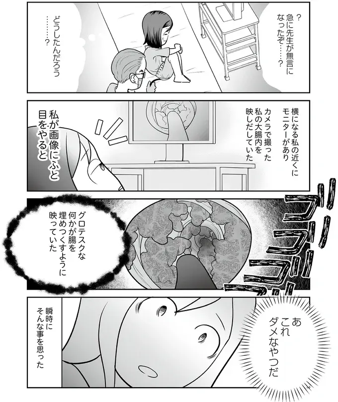 『痔だと思ったら大腸がんステージ4でした』（21）