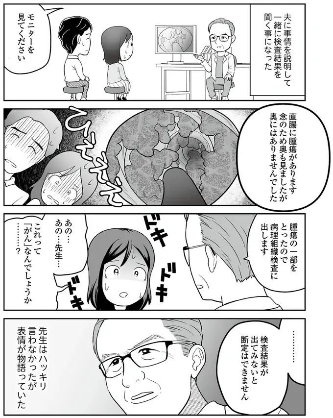 カメラを腸に入れた途端、医師は「無言になった」。モニターに映っていたものは／痔だと思ったら大腸がんステージ4でした（5）