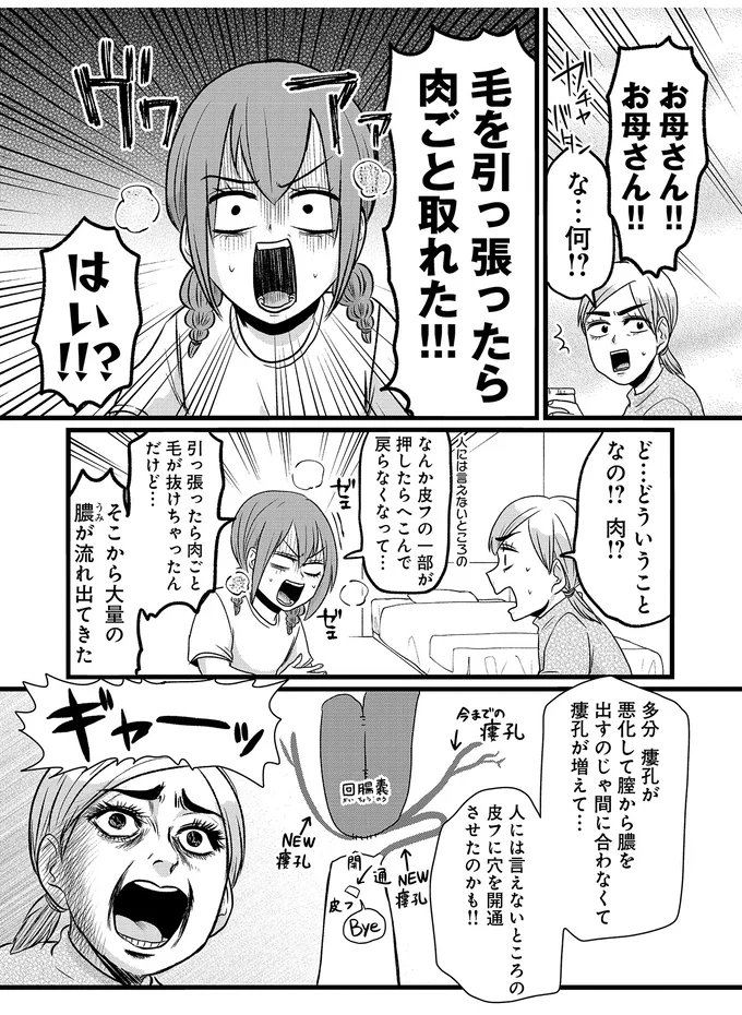 『腸よ鼻よ6〜10』（191）