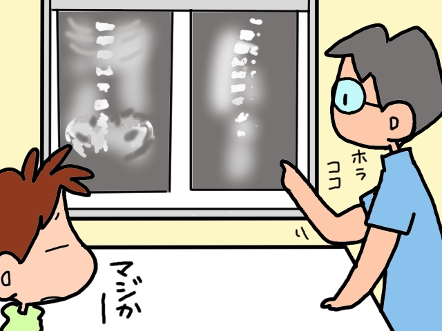 転倒した義母の様子がおかしい！ レントゲン撮影で判明したのは...⁉／山田あしゅら（7）
