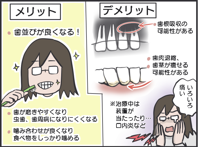 40代主婦「歯科矯正」はじめました。費用は？ 痛みは？ 食事はどうする？ 体験レポ／フニャコ（2）