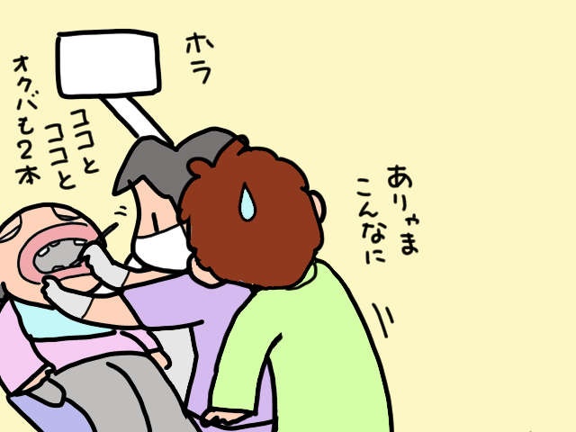 「食べる」動作がおぼつかない認知症の義母。気づけば虫歯だらけになっていて... ／山田あしゅら（4）