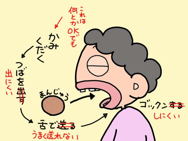 「食べる」動作がおぼつかない認知症の義母。気づけば虫歯だらけになっていて... ／山田あしゅら（5）