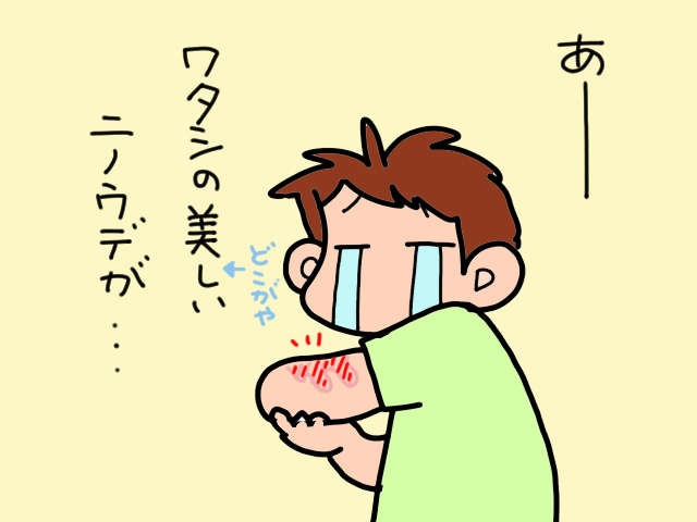 自立歩行が困難な認知症義母。教わった方法で「手引き歩行」してみると...思わぬ代償が！／山田あしゅら（9）