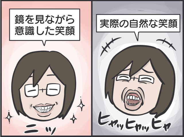 40代で始めた歯科矯正。装置を外して1年経った今、どんな変化が？／フニャコ（6）
