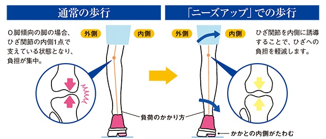 ひざの悩みは正しいシューズ選びから！歩くことが楽しくなるシューズで快適ウォーキング＜PR＞（2）