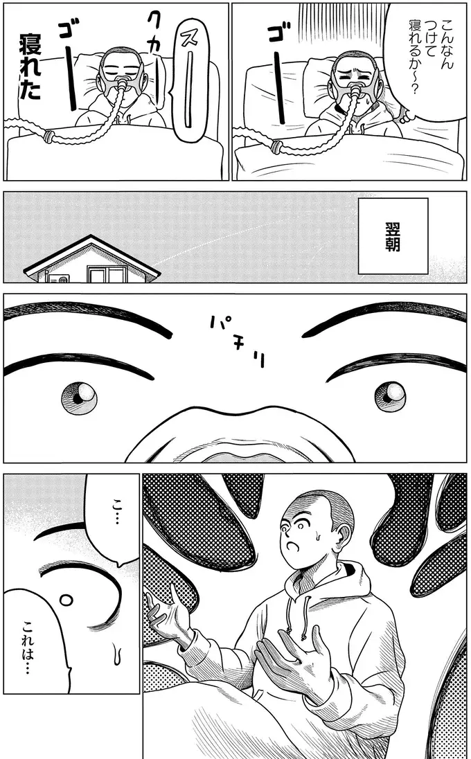 「CPAP治療してみます？」と医師。不安になりながらも使ってみた結果は／ドキュメントSAS（8）