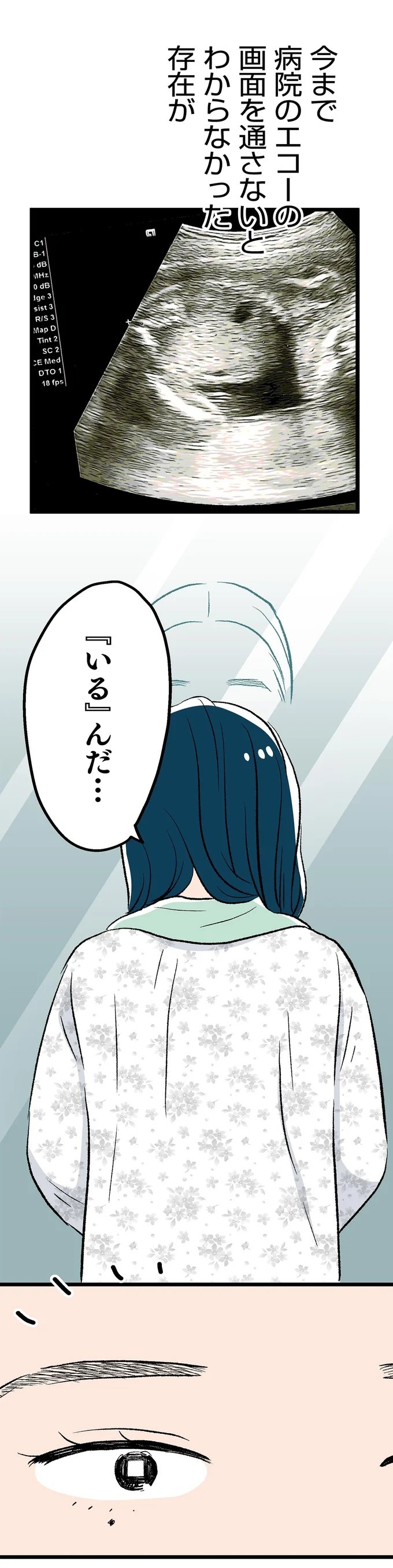 最愛の彼との結婚式。この幸せがずっと続くと思っていたのに…／くらやみガールズトーク1（画像348/417枚目）